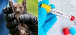 maladie-a-virus-marburg-la-cote-divoire-prend-des-dispositions